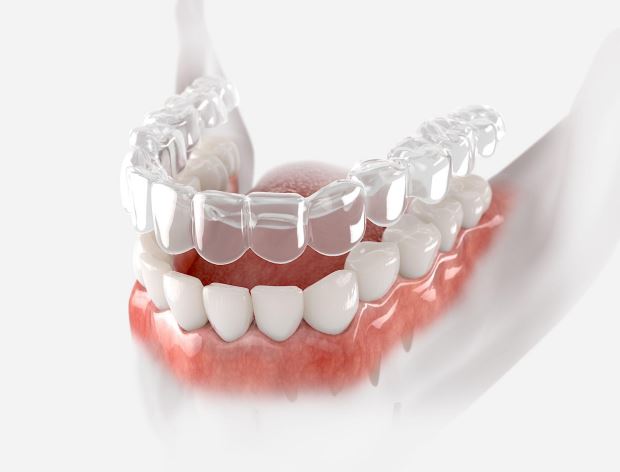Services aligners